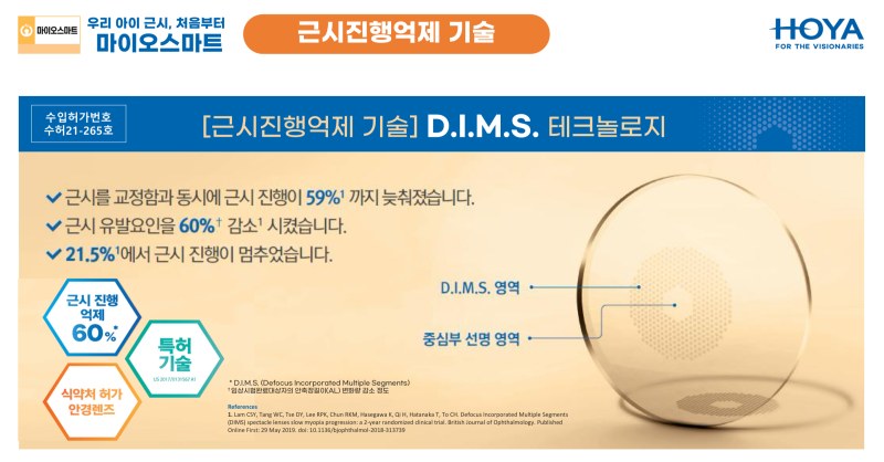 천안안경점 천안마이오스마트 - 마이오스마트 DIMS기술 이미지